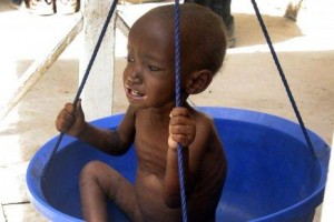 Situation nutritionnelle enfants Mali
