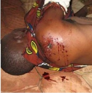 Centrafrique Bangui enfant victimes balles perdues éclats grenade machettes