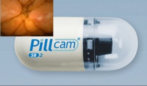 Cette pilule avalée vous fait découvrir votre colon, vos intestins et votre anus…