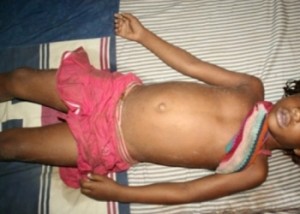 Cote d’Ivoire / Une fillette de 3 ans violé puis tuée : La ville de Fresco paralysée